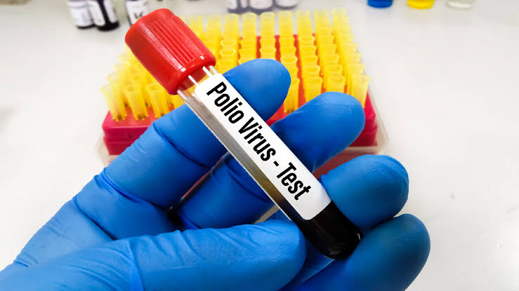 Poliovirus Detected in Nine Districts Confirmed by Pakistan's Health Ministry